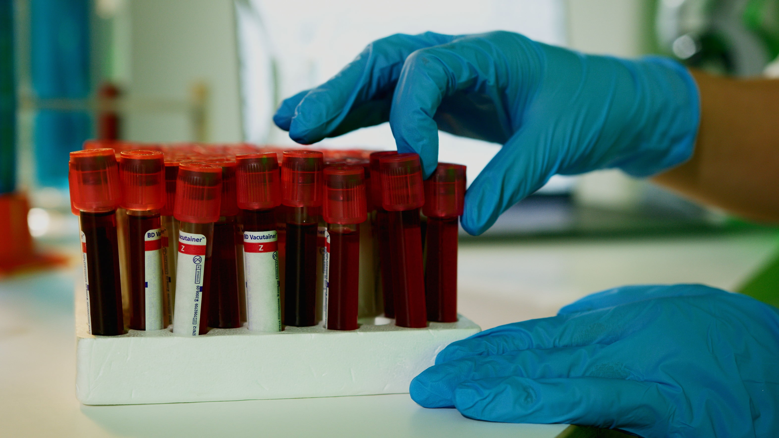 Understanding Your Blood Test Results in Kenya: A Plain Language Guide
